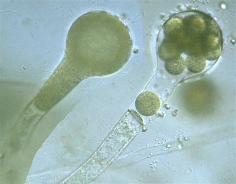 Protist Images: Saprolegnia