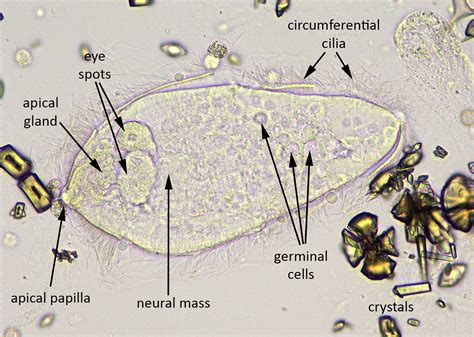 Creepy Dreadful Wonderful Parasites: Answer to Case 518