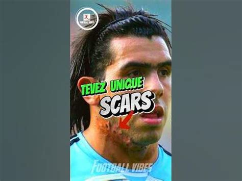 😱The Secret Behind Carlos Tevez Scars! “Shocking”😱 #football #footballnews #soccer - YouTube