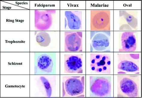 Giemsa Stain - Preparation, Procedure, Principle, Composition and Application - Biology Notes Online