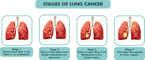 Cancer Caregivers: Getting Support Through The Cancer Journey