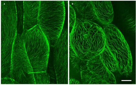 Plants | Free Full-Text | Plasmolysis: Loss of Turgor and Beyond