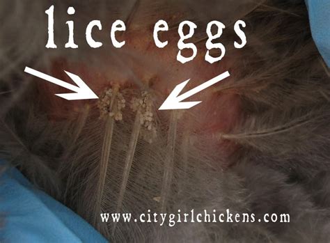 lice-eggs - CITY GIRL FARMING and ART