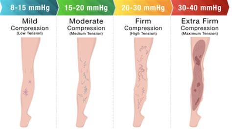 TED Hose: Best Recommended Guide to TED Stockings vs Compression Socks