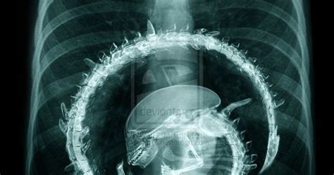 Xenomorph x ray by Anto-Z | ALIEN. XENOMORPH. GIGER. | Pinterest | Xenomorph, Aliens and deviantART