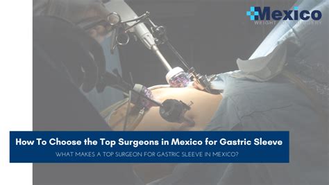 How To Choose the Top Surgeons in Mexico for Gastric Sleeve Surgery ...