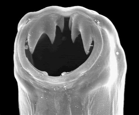 Hookworm Infection (Ancylostomiasis): Morphology, Life Cycle And Clinical Presentations | HubPages