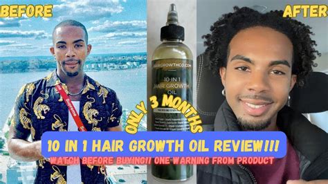 6 MONTH REVIEW!! : *10-in-1 Hair Growth Oil*- one side effect! Watch Before Buying! - YouTube