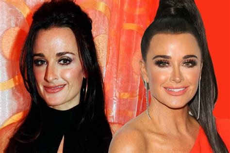 Kyle Richards Before And After: The Real Housewives Of Beverly Hills ...