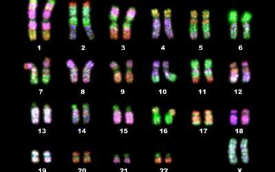 Karyotype Test Purpose and Steps