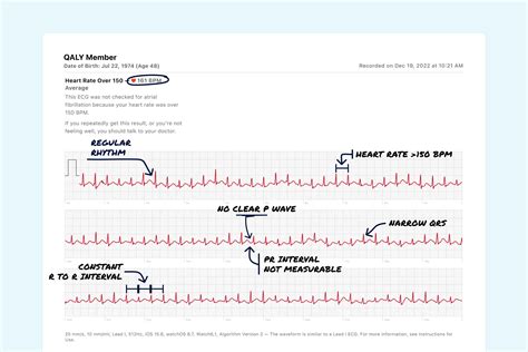 Labile Affect: Definition, Symptoms, Causes, Treatment, 42% OFF