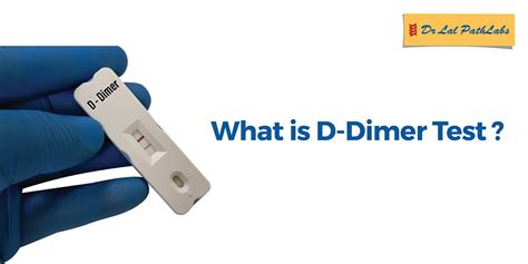 D-Dimer Test - What It Is, Who Needs It, and Its Risk Factors - Dr Lal PathLabs Blog