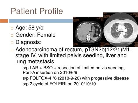 Colon cancer with brain metastasis