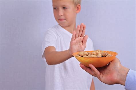 Food Allergies: What Parents Should Know - Health BeatHealth Beat