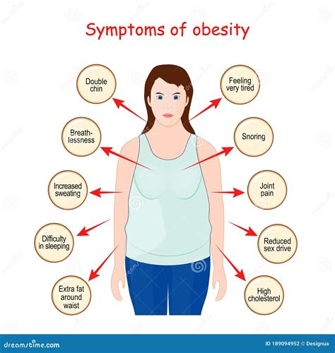 Obesity sign and Symptoms stock vector. Illustration of lifestyle ...