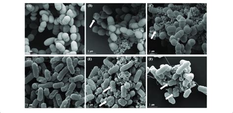 Bacterial Cell Under Electron Microscope