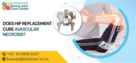 avascular necrosis hip treatment - Dr. Shailendra Patils Bone & Joint Care Center