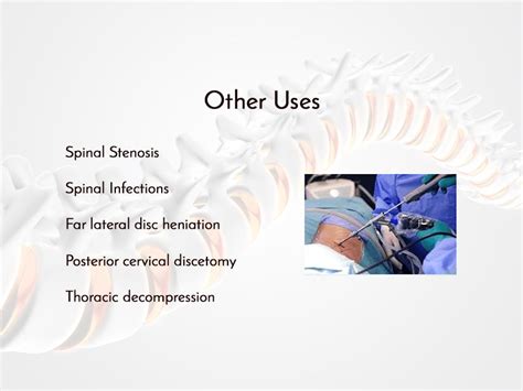 Endoscopic Spine Surgery, Slipped disc, Spinal fusion surgery, Mumbai