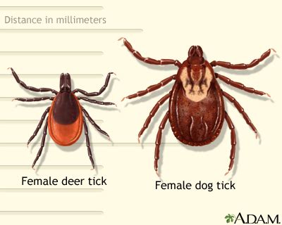 Deer and dog tick: MedlinePlus Medical Encyclopedia Image