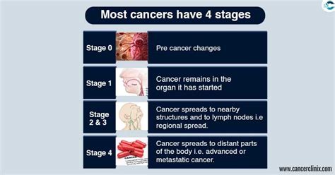 Cancer Stages Chart