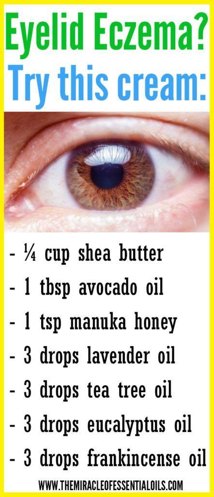 Check out these essential oils for eczema on eyelids to find natural relief fast. | Oils for ...