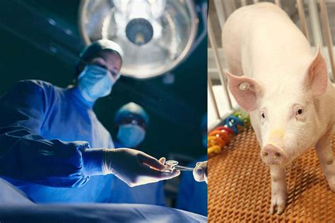 Scientists Successfully Transplant Pig Kidney into Human Host - Long ...