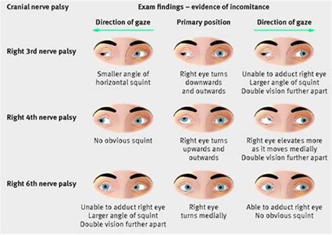 #ophthalmology #neuroscience #neurology #pathology #internalmedicine # ...