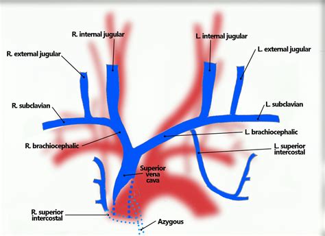 Pin by Andrew Brande on Cardiac Surgery | Radiology technician ...