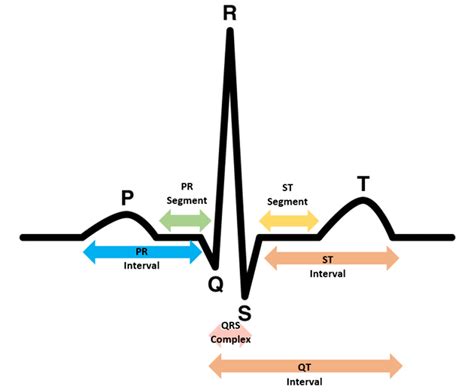 Bundle Branch Block - Causes, Symptoms, Diagnosis, Treatment