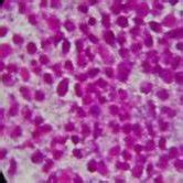 gram stain shows plenty of pus cells | Download Scientific Diagram