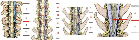 Spinal Cord (Gross Structure, Functions of Afferent and Efferent Nerve ...