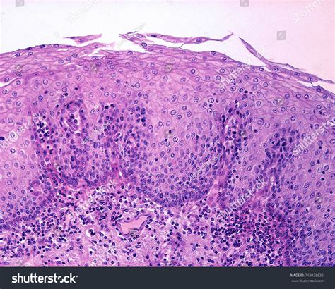 Stratified Squamous Epithelium Non Keratinized Labeled