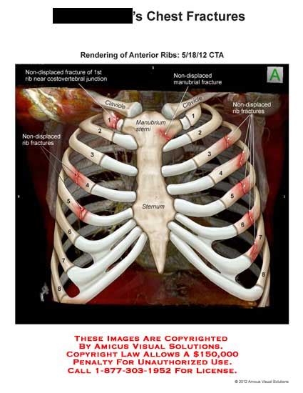 Medical Exhibits, Demonstrative Aids, Illustrations and Models