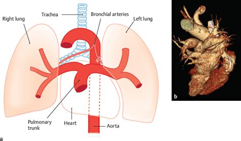 Pulmonary Arteries | Radiology Key