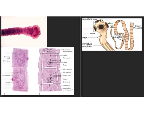 Tapeworm Anatomy Quiz