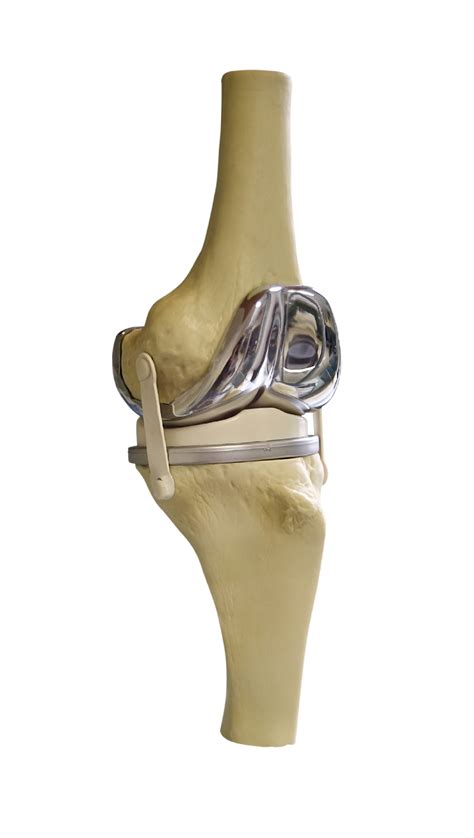 Knee Replacement Recovery: Guidelines, Tips, & Equipment | University of Utah Health ...