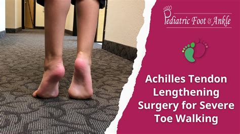 Achilles Tendon Lengthening Surgery for Severe Toe Walking - YouTube