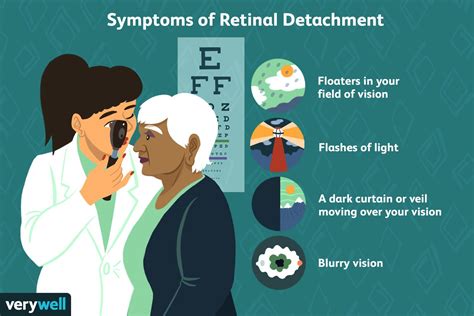 Retinal Detachment Vision