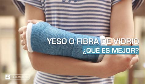 Tipos de yesos para fracturas | Actualizado diciembre 2024