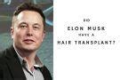 Did Elon Musk Get a Hair Transplant? - Before and After | PMHR