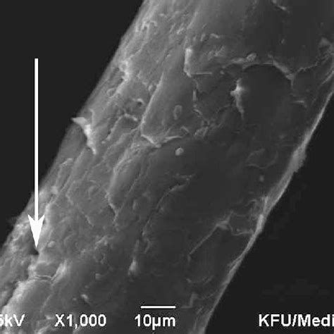 (PDF) Scanning Electron Microscopy Study of Hair Shaft Damage Secondary to Cosmetic Treatments ...