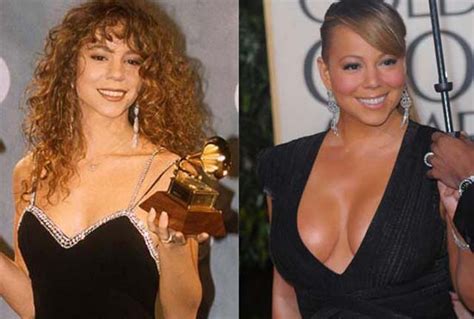 Mariah Carey Breast Implants Plastic Surgery Before and After | Celebie