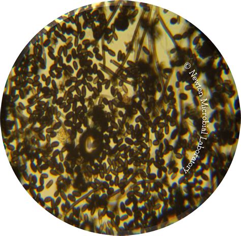 Black Mold Pictures, under the microscopes | Mold Awareness