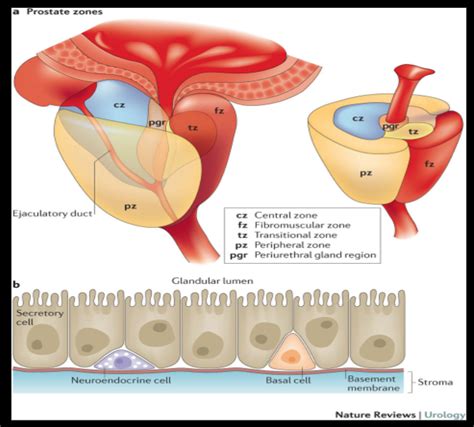 Prostate: Anatomy, Function, and Treatment - kienitvc.ac.ke