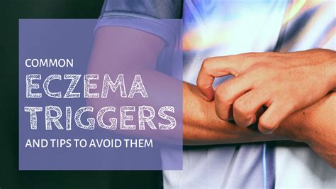 Top eczema triggers to avoid | Eczemaless