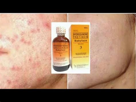 RDL Babyface Solution 3 Review - YouTube