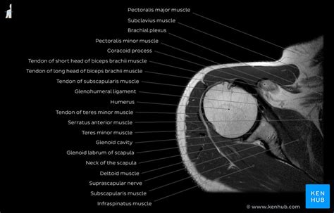 Normal shoulder MRI: How to read a shoulder MRI | Kenhub