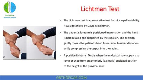 Lichtman Test Midcarpal Instability