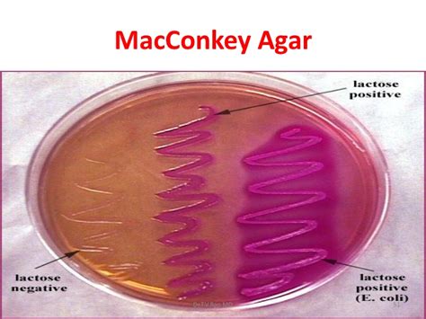 MacConkey Agar : Principles, Composition, Preparation, uses and colony ...