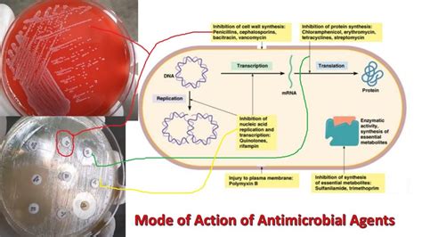 Antimicrobial Agent: Therapy, Properties, Factors Influencing and Classifi